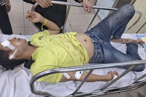 Bị chó rượt, hai vợ chồng bị té trọng thương