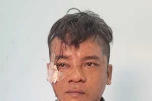 Bắt kẻ cướp từ TP.HCM xuống Long An giật dây chuyền 