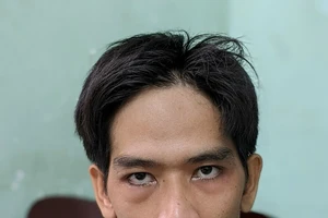  Bắt tên trộm chém bảo vệ, cướp xe máy bỏ trốn ở Long An