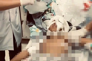 Chơi gần nhà, bé trai 11 tuổi bị chó Becgie cắn nhập viện cấp cứu