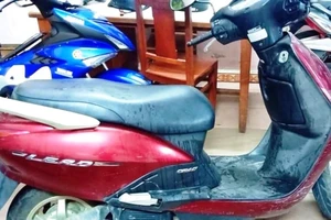 Cô gái bị tạt acid khi đứng chờ bạn ven đường 