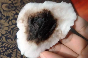 Sở Y tế vào cuộc vụ nước đục, có vị lợ ở Đà Nẵng