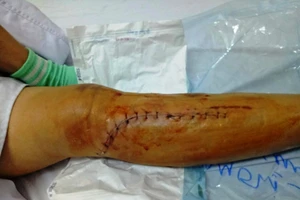 Nam quản lý siêu thị đánh nữ kế toán gãy chân