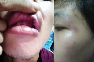 Người đập bàn khi hỏi tiền hỗ trợ COVID-19 bị phạt 200.000 đồng