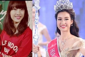 Tân hoa hậu bị tố phẫu thuật thẩm mỹ răng, ban tổ chức nói gì?