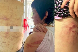 Giải pháp nào cho phụ nữ bị bạo lực gia đình?