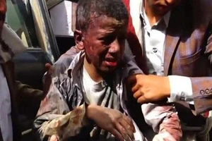 Vũ khí Mỹ và mạng người Yemen