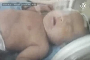 Truy tìm cha mẹ chôn sống con trên đồi