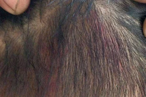 Thực hư chuyện hiệu phó túm tóc dập đầu học sinh vào tường