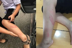 Cô giáo tát học sinh giờ kiểm tra bị đình chỉ 6 tháng