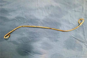 Ống thông niệu quản bị bỏ quên 4 năm trong người cụ bà 80 tuổi 