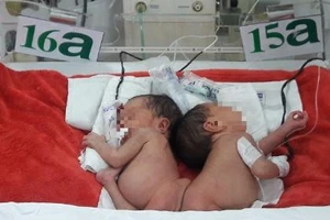 Chất lượng cuộc sống sau phẫu thuật tách dính sẽ không tốt