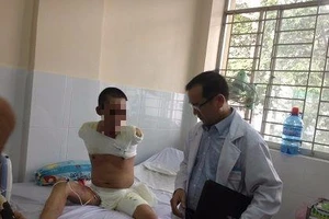Cắt hai tay và 1 chân cứu bệnh nhân bị phỏng điện