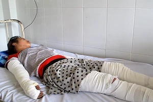 Cô gái nghi bị người yêu đốt gặp nhiều biến chứng thẩm mỹ
