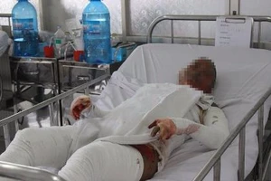 Cô gái bị bỏng nhảy từ lầu 1 xuống đất đang nguy kịch