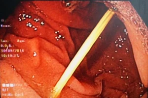 Ăn bánh canh nuốt luôn tăm tre mà không biết