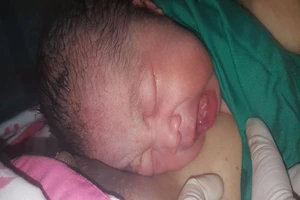 Bé sinh ra đã mọc 2 răng cửa, có bình thường không?