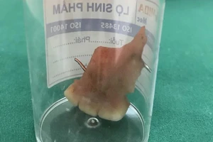 Cứu sống nam bệnh nhân nuốt 3 răng giả khi ngủ