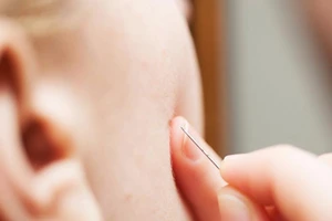 Cô gái suýt chết vì... nặn mụn