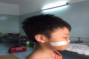 Té xe, nôn ói 3 lần mới được đưa đi viện