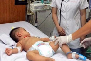 TP.HCM: Bé 2 tuổi tử vong do viêm não mô cầu