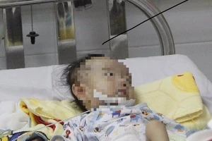 Bé mắc 3 dị tật lạ được cứu nhờ sức sống mãnh liệt