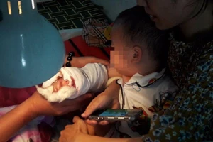 Thông tin mới vụ bé trai bị thang cuốn kéo đứt cổ tay