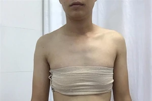 Sắp tiến hành ca phẫu thuật chuyển giới đầu tiên tại VN