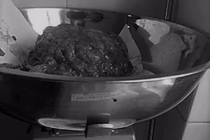 Cắt bỏ vú, viêm nhiễm nặng do bị 'thẩm mỹ dỏm' lừa gạt