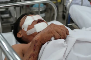 Lời kể của nạn nhân bị kẹp dính vào đầu xe sau tai nạn