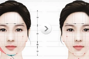 Tai biến nguy kịch sau khi đi gọt hàm