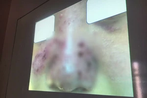 ​Thẩm mỹ chui ở chung cư, bỏ 1 đồng trả giá gấp 10 lần