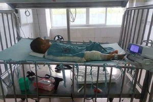 Ngã vào nồi bỗng rượu đang sôi, bé 3 tuổi nguy kịch