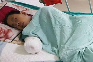 Trèo tường bị điện giật bất tỉnh, phải cắt cụt cánh tay