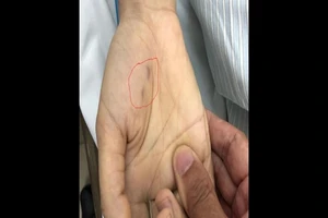 Hi hữu: Bác sĩ thú y tử vong tức tưởi vì bị chó cắn 