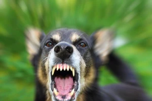 Bé 2 tuổi bị chó béc giê hàng xóm cắn hỏng mắt nguy kịch