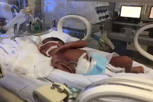 Sức khỏe người mẹ ung thư nỗ lực sinh con đang xấu đi