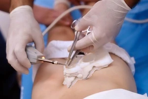 Nam thanh niên bị cần cẩu công trình móc rách tinh hoàn