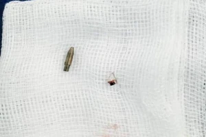 Bạn học nghịch cắm bút bi dưới ghế, bé trai phải mổ cấp cứu