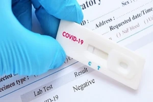 Bộ Y tế ban hành thông tư hướng dẫn giá xét nghiệm SARS-CoV-2