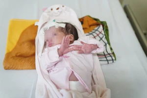 Tách thành công khối u bạch huyết khổng lồ trên mình bé 10 ngày tuổi