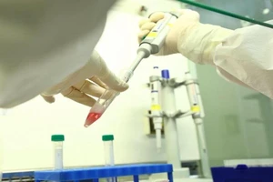 CDC Hà Nội không mua kit test của Việt Á, chỉ dùng hàng tài trợ