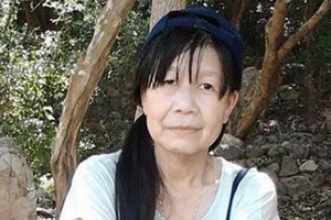 Kỳ lạ cô gái 21 tuổi có gương mặt như bà già