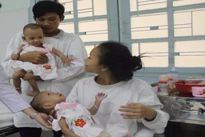 Hơn 400 ngày nằm viện cặp đôi dính liền sắp được về nhà