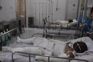 Lụy tình, chồng cũ tạt xăng đốt vợ và người yêu