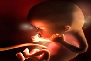 Bé sắp chào đời chết lưu vì mẹ ăn quá nhiều đồ ngọt