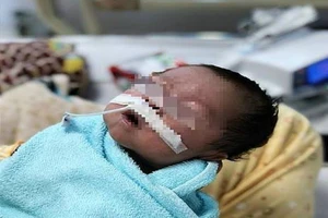 Hồi hộp cứu bé sơ sinh bụng căng như quả bóng sắp vỡ