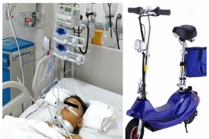 Bé trai bị vỡ thanh quản nguy kịch khi té xe trượt điện