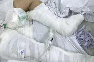 Bé gái 13 tuổi rơi từ lầu 3 chấn thương nặng