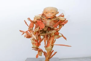 Người chết 'kể' bí ẩn cơ thể người lần đầu tiên ở Việt Nam